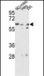 GNS Antibody (Center S298)